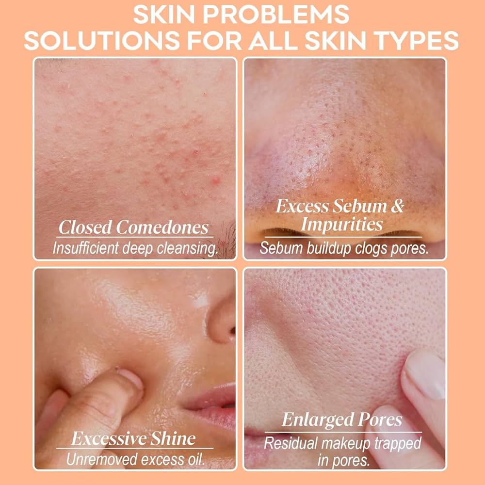 Amazon.com : SYABO Deep Pore Clay Mask, Blackhead Remover